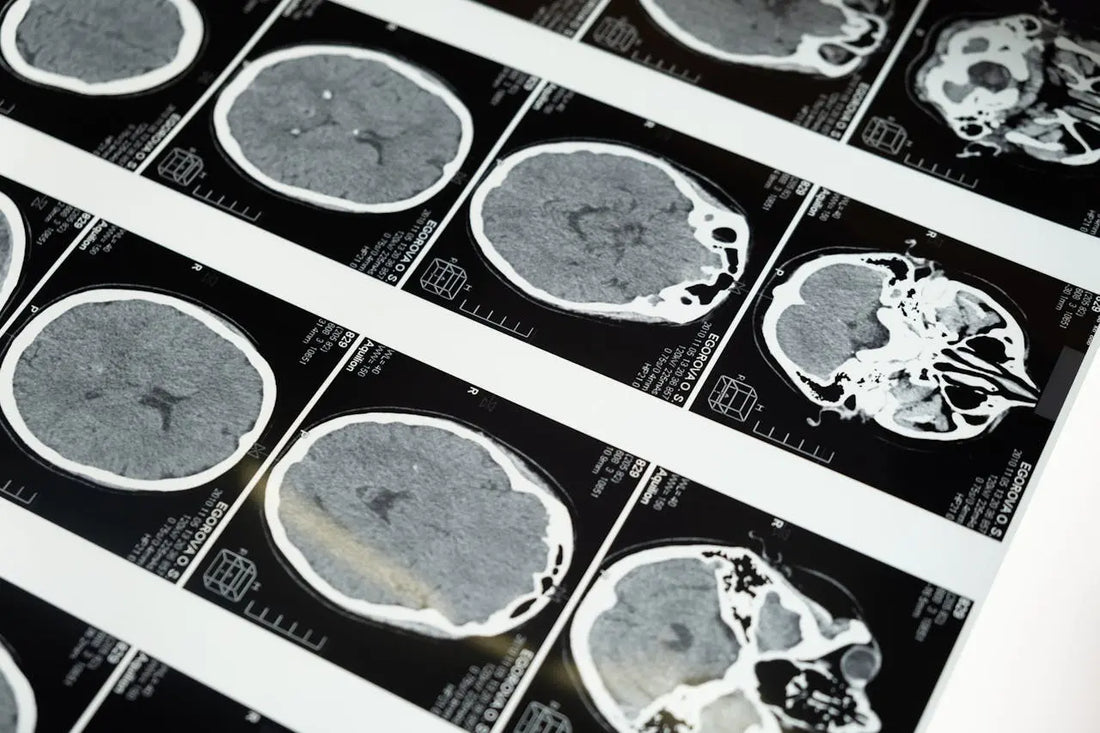Nurturing Your Mind: Essential Strategies for Brain Health & Longevity