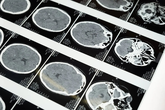 Nurturing Your Mind: Essential Strategies for Brain Health & Longevity